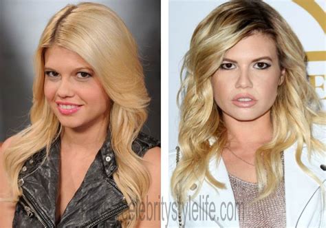 chanel west coast teeth|Chanel West Coast Plastic Surgery Before and After